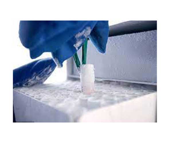 Étiquettes de congélation ultra basse pour tube à vis cryogénique de  laboratoire – Ruilabels
